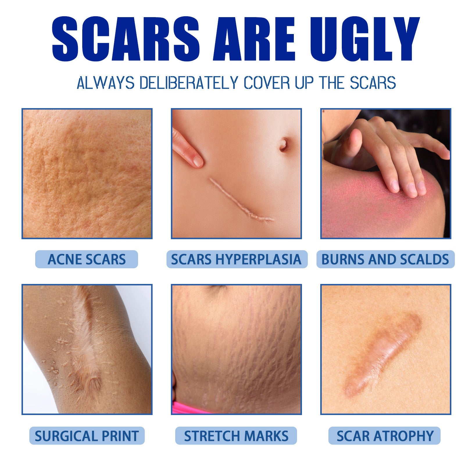 Scar Repair Cream